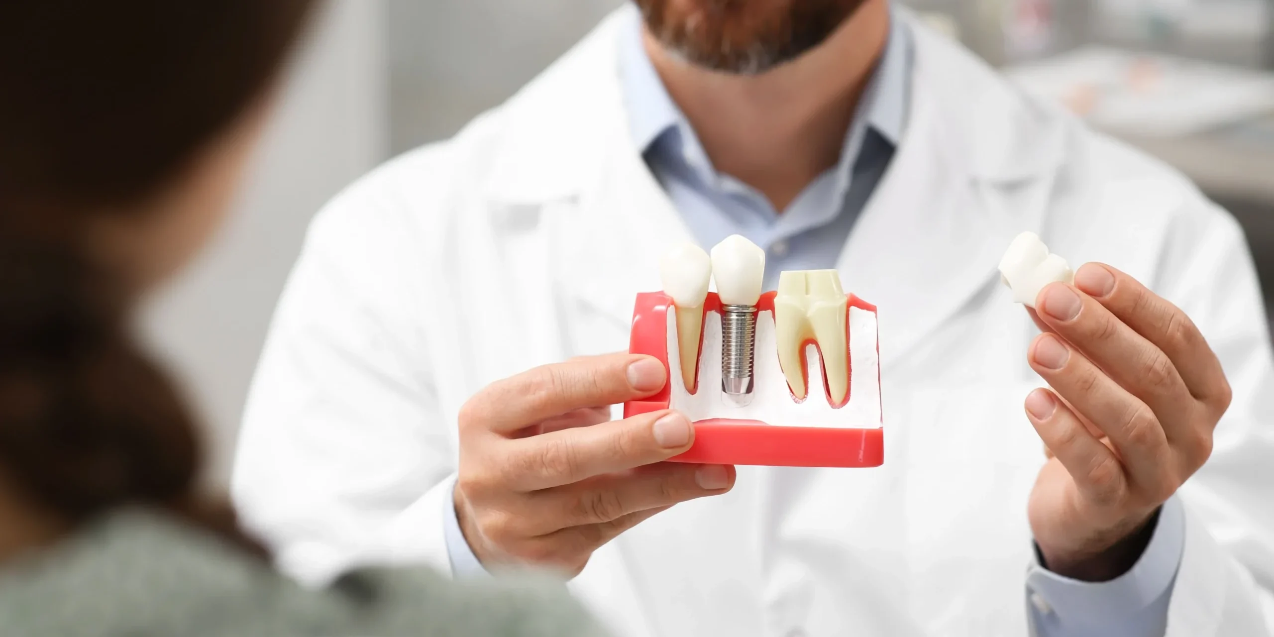 Dentist explains options for tooth replacement to a female patient