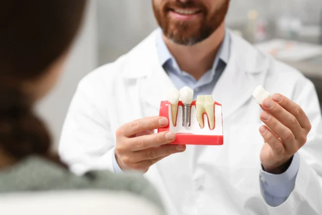 Dentist showing teeth replacement options to a patient Dentist explains options for tooth replacement to a female patient