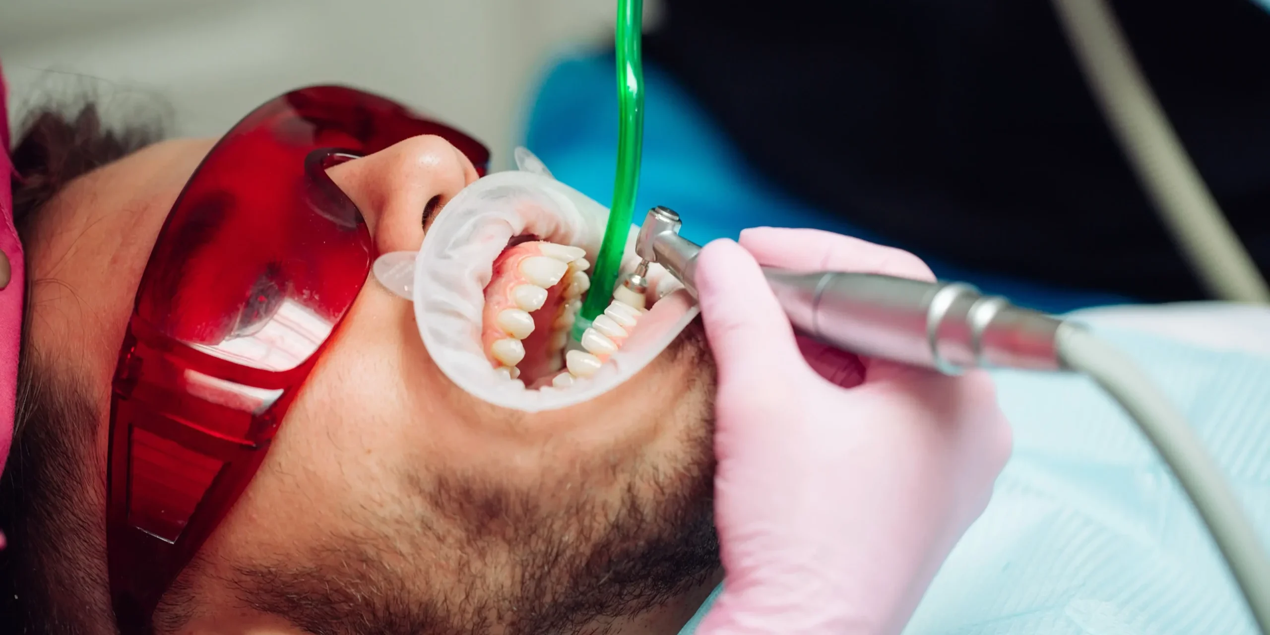 Man getting his teeth cleaned