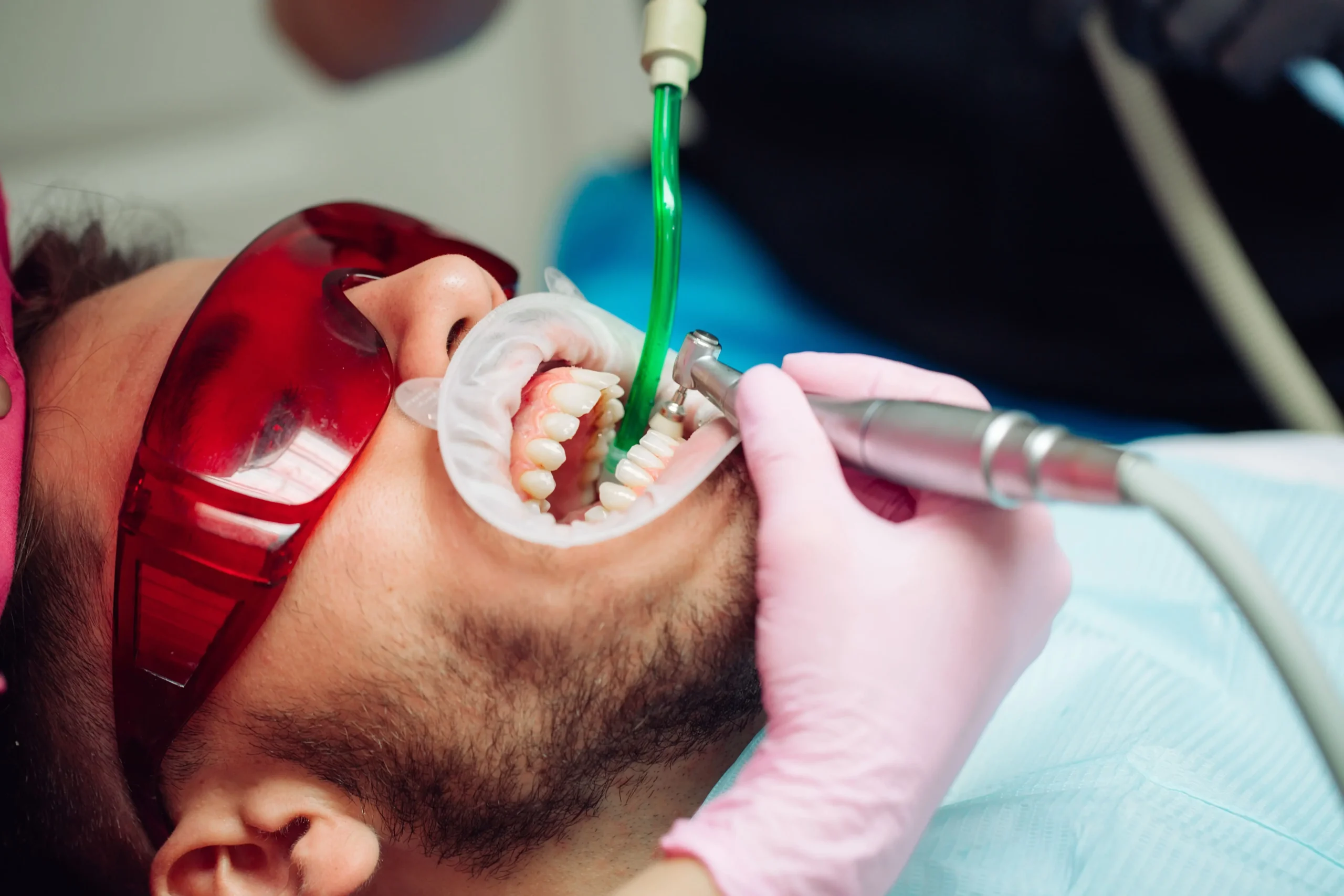 Man getting his teeth cleaned