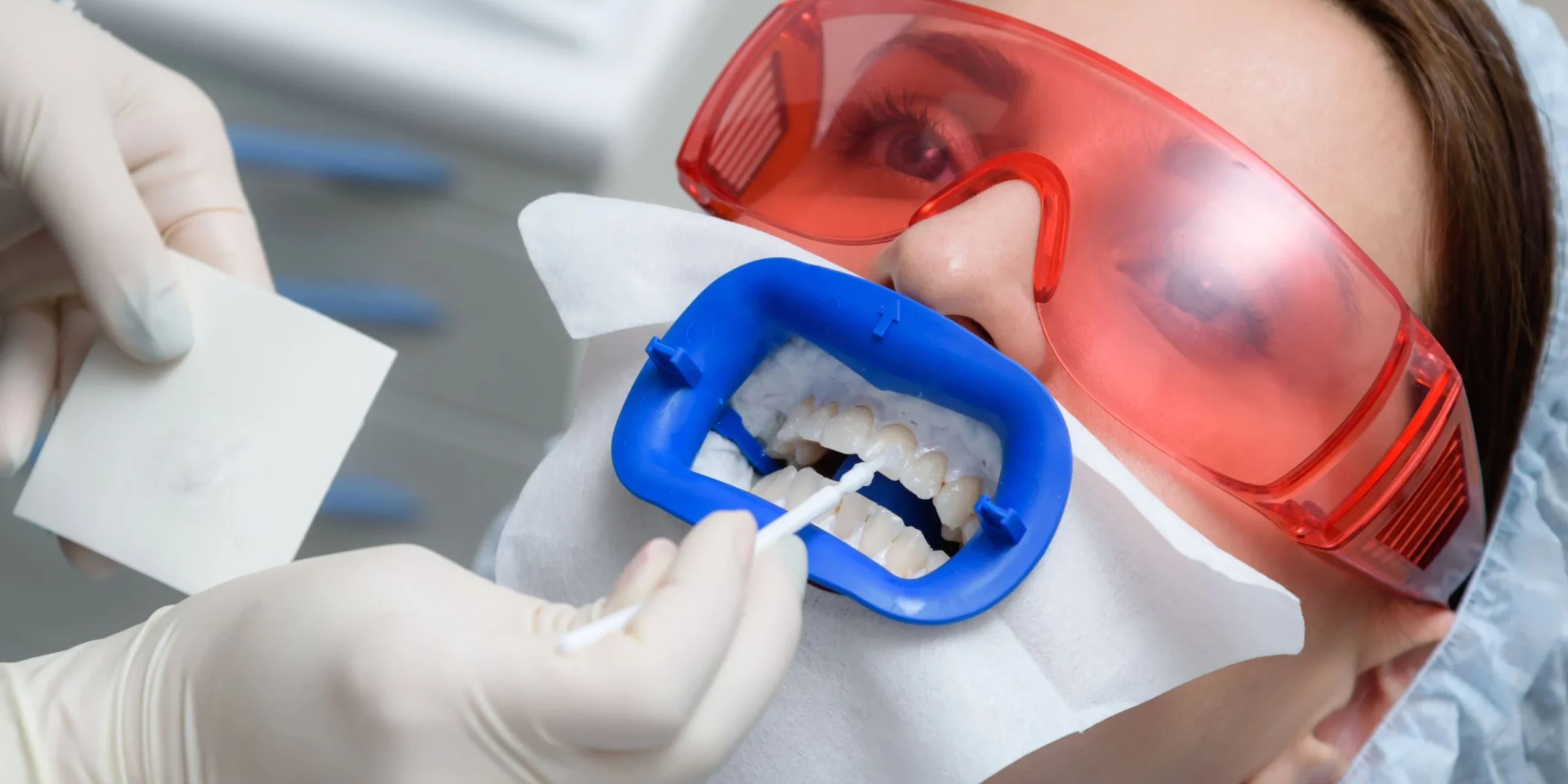 Teeth whitening at the dentist