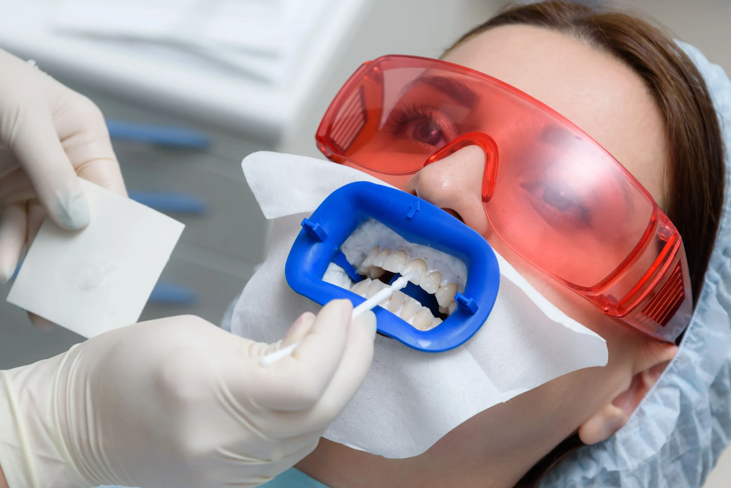 Teeth whitening at the dentist