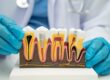 Root canal vs dental implants